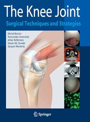 Immagine del venditore per The Knee Joint : Surgical Techniques and Strategies venduto da AHA-BUCH GmbH