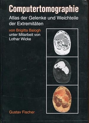 Bild des Verkufers fr Computertomographie. Atlas der Gelenke und Weichteile der Extremitten. zum Verkauf von Antiquariat am Flughafen