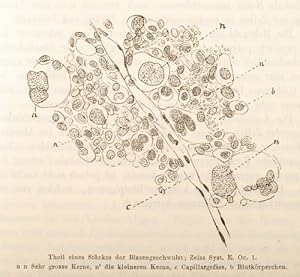 Blasengeschwülste bei Fuchsin-Arbeitern (pp.588-600, 1 Abb.).