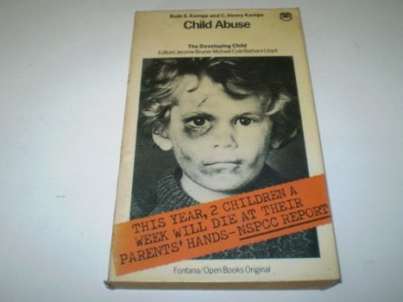 Imagen de archivo de Child Abuse (Developing Child S.) a la venta por AwesomeBooks