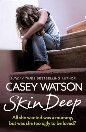 Beispielbild fr Skin Deep : All She Wanted Was a Mummy, but Was She Too Ugly to Be Loved? zum Verkauf von Better World Books