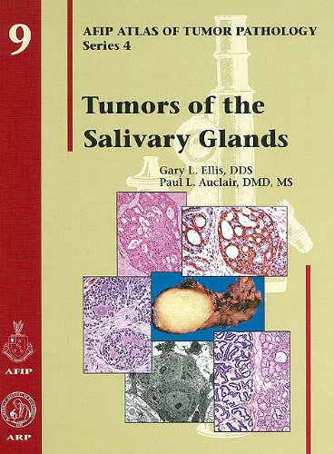 Stock image for Tumors of the Salivary Glands (AFIP Atlas of Tumor Pathology: Series 4) for sale by Iridium_Books