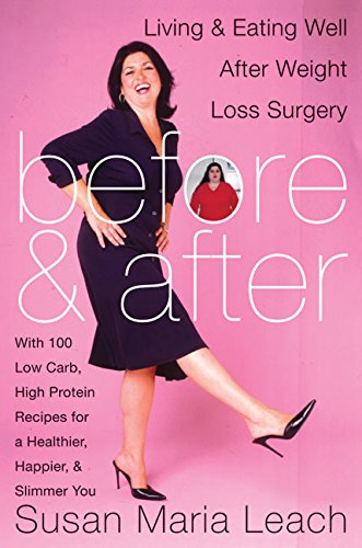Beispielbild fr Before and After : Living and Eating Well after Weight-Loss Surgery zum Verkauf von Better World Books