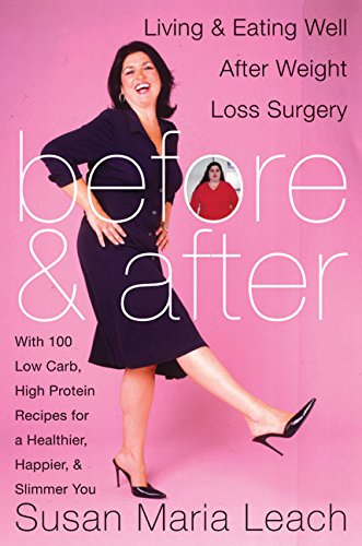 Imagen de archivo de Before and After: Living and Eating Well After Weight Loss Surgery a la venta por Gulf Coast Books