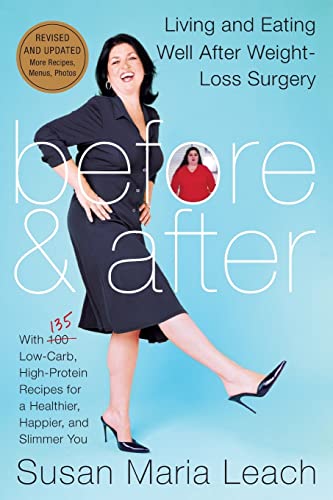 Stock image for Before & After, Revised Edition: Living and Eating Well After Weight-Loss Surgery for sale by Ergodebooks