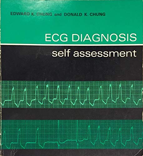 ECG diagnosis: self assessment (9780061406386) by Edward K. Chung