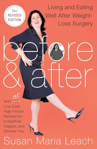 Stock image for Before & After, Second Revised Edition: Living And Eating Well After Weight-Loss Surgery for sale by SecondSale