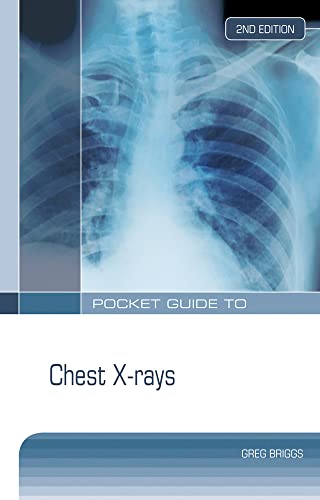 Stock image for Pocket Guide to Chest X-rays for sale by Books From California