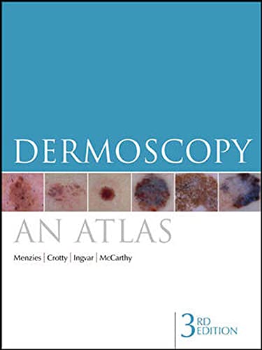 9780070159099: Dermoscopy: An Atlas