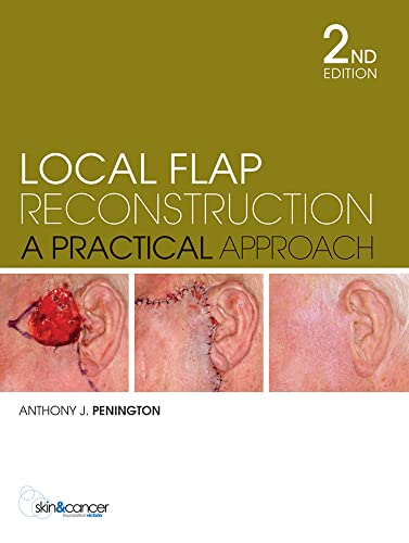 9780070278387: Local Flap Reconstruction