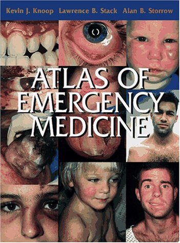 Stock image for Atlas of Emergency Medicine for sale by HPB-Red