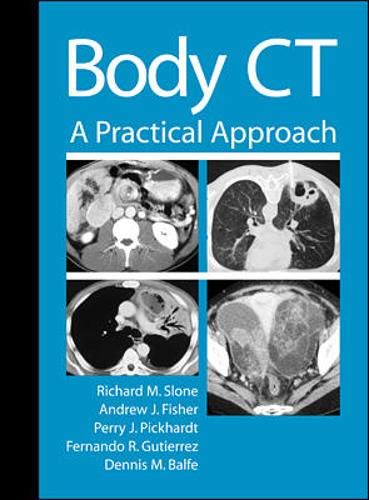 Beispielbild fr Body CT: A Practical Approach zum Verkauf von Reuseabook
