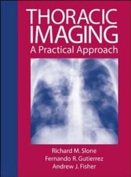 Beispielbild fr Review of Thoraic Imaging and Chest Disease : A Practical Approach zum Verkauf von Better World Books