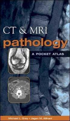 9780071212557: CT and MRI Pathology: A Pocket Atlas