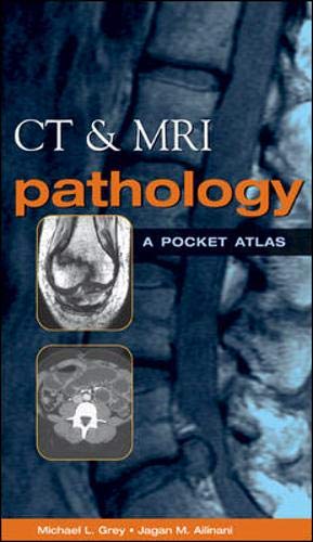 Stock image for CT MRI Pathology: A Pocket Atlas for sale by Seattle Goodwill