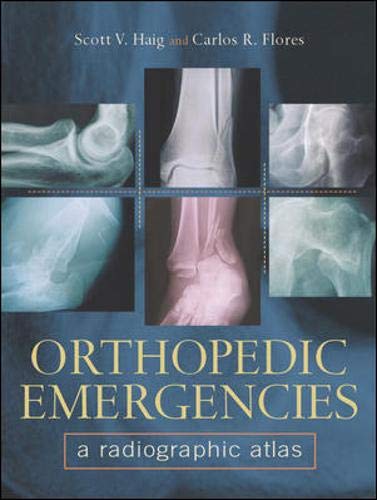 Imagen de archivo de Orthopedic Emergencies: A Radiographic Atlas Haig, Scott V. and Flores, Carlos R. a la venta por tttkelly1