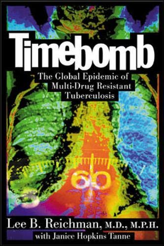 9780071422505: Timebomb : The Global Epidemic of Multi-Drug Resistant Tuberculosis