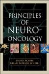 Stock image for Principles and Practice of Neuro-Oncology for sale by Jenson Books Inc