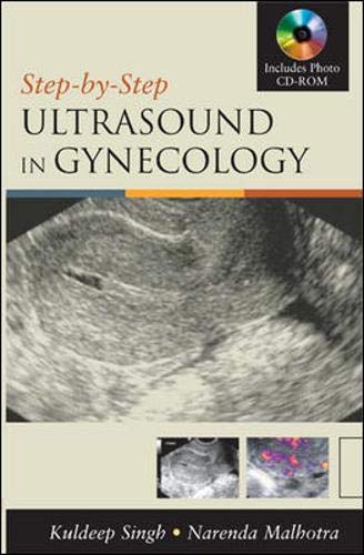 Beispielbild fr Ultrasound in Gynecology, w. Photo CD-ROM (Step By Step) zum Verkauf von Buchpark