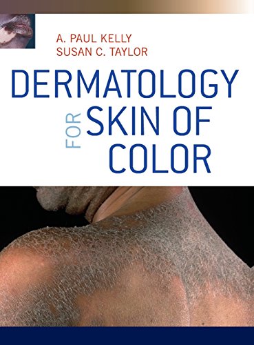 Dermatology for Skin of Color