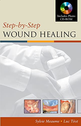 Stock image for Step-By-Step Wound Healing for sale by Hippo Books
