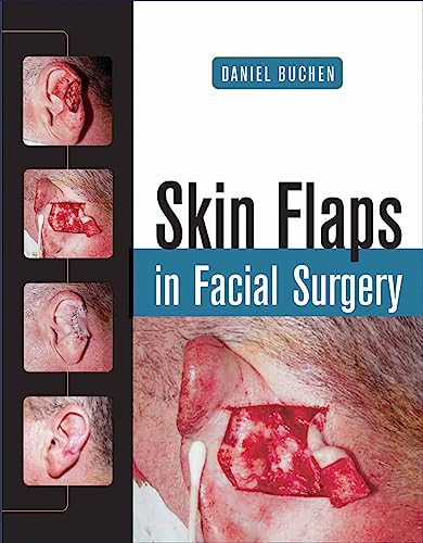 Stock image for Skin Flaps in Facial Surgery for sale by HPB-Red