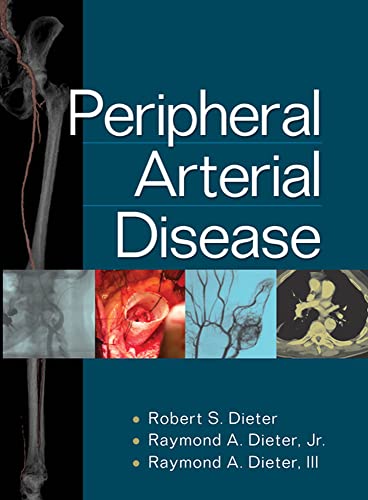 Beispielbild fr Peripheral Arterial Disease zum Verkauf von Books From California