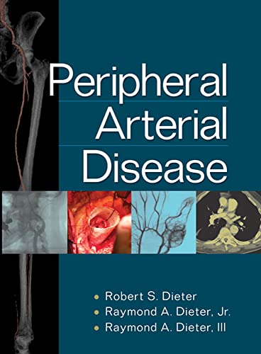 9780071481793: Peripheral arterial disease