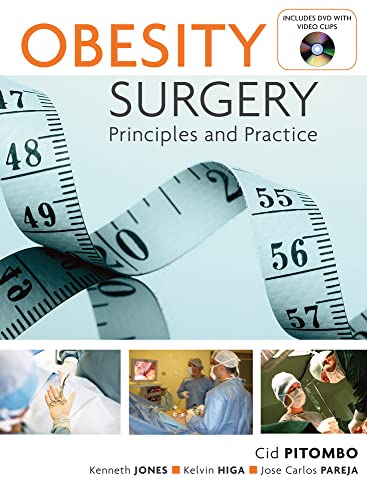 9780071482813: Obesity Surgery: Principles and Practice