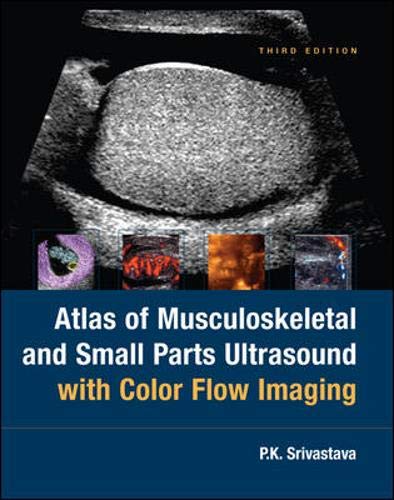 Stock image for Atlas Of Musculoskeletal and Small Parts Ultrasound with Color Flow Imaging for sale by HPB-Red