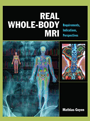 Real Whole-body Mri