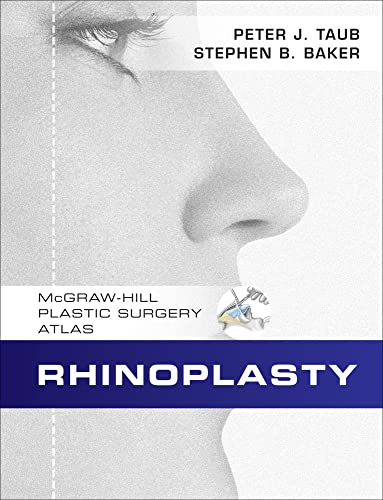 Stock image for Rhinoplasty for sale by Better World Books