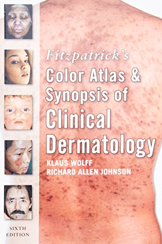 Beispielbild fr Fitzpatrick's Color Atlas and Synopsis of Clinical Dermatology: Sixth Edition (Fitzpatrick's Color Atlas & Synopsis of Clinical Dermatology) zum Verkauf von HPB-Red