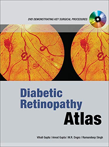 Beispielbild fr Diabetic Retinopathy Atlas zum Verkauf von Iridium_Books