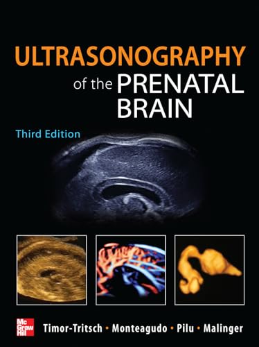 9780071613064: Ultrasonography of the prenatal & neonatal brain (Medicina)