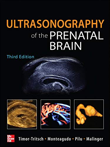 9780071613064: Ultrasonography of the Prenatal Brain, Third Edition (OBSTETRICS/GYNECOLOGY)