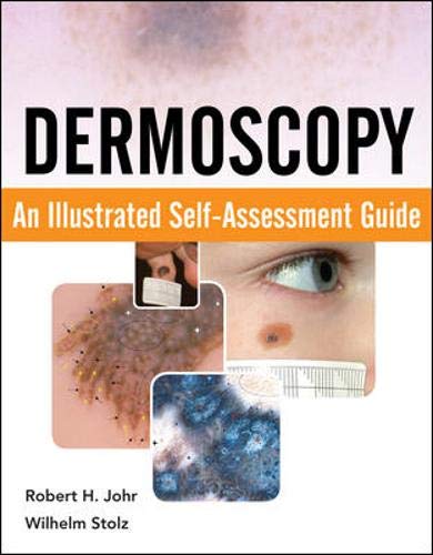 9780071613552: Dermoscopy: an illustrated self-assessment guide
