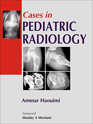 Beispielbild fr Cases in Pediatric Radiology zum Verkauf von ThriftBooks-Dallas