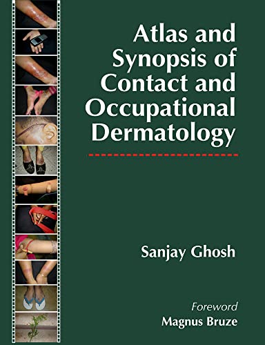 Beispielbild fr Atlas and Synopsis of Contact and Occupational Dermatology zum Verkauf von Books From California