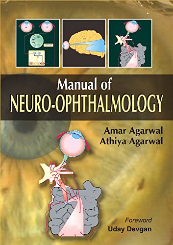 Stock image for Manual Of Neuro-ophthalmology for sale by Basi6 International