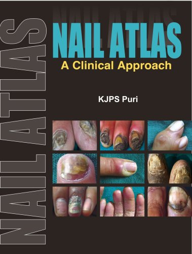 9780071632362: Nail Atlas: A Clinical Approach