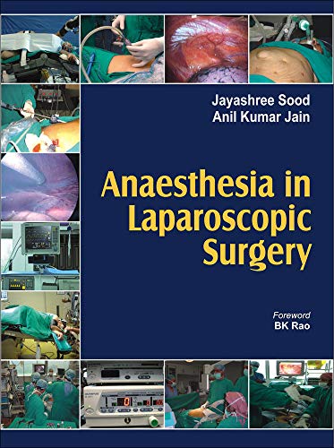 Beispielbild fr Anaesthesia in Laparoscopic Surgery zum Verkauf von Books From California