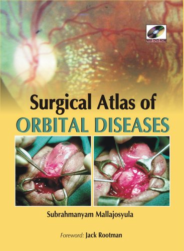 9780071634267: Surgical Atlas of Orbital Diseases