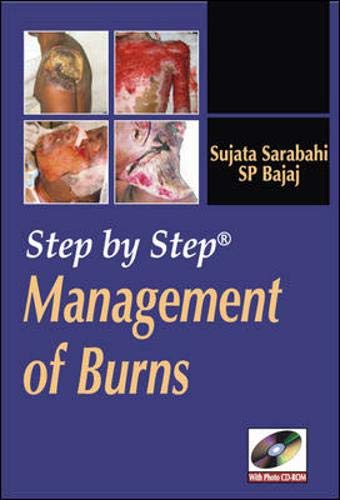 9780071634304: Step by Step Management of Burns