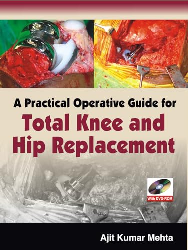 Stock image for A Practical Operative Guide for Total Knee and Hip Replacement for sale by Books From California