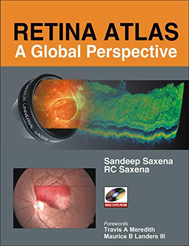 9780071634403: Retina Atlas: A Global Perspective (MEDICAL/DENISTRY)