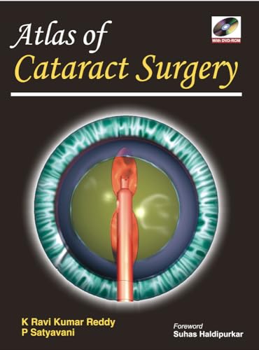 9780071634458: Atlas of Cataract Surgery