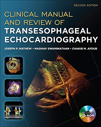 Beispielbild fr Clinical Manual and Review of Transesophageal Echocardiography zum Verkauf von BooksRun