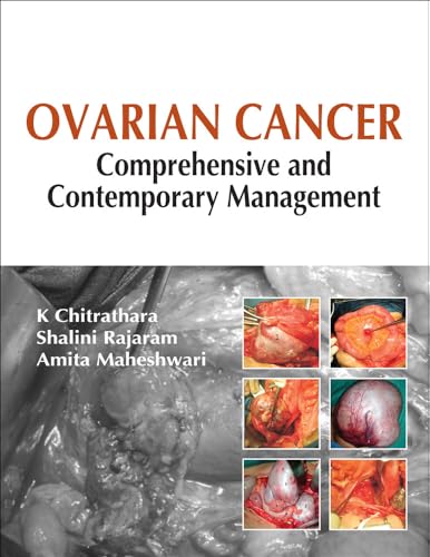 Stock image for Ovarian Cancer: Comprehensive and Contemporary Management for sale by Bookoutlet1