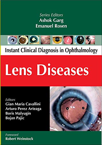 Stock image for Lens Diseases (Instant Clinical Diagnosis in Ophthalmology) for sale by GoldBooks